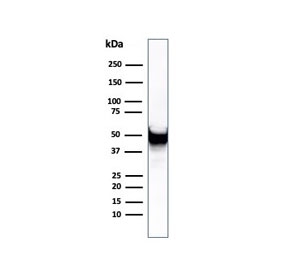 Western blot testing of human U-87 MG cell lysate using recombinant VIM antibody (clone rVIM/6431). Predicted molecular weight ~53 kDa.