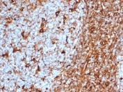 IHC staining of FFPE human tonsil tissue with Vimentin antibody (clone rVIM/6575). HIER: boil tissue sections in pH 9 10mM Tris with 1mM EDTA for 20 min and allow to cool before testing.