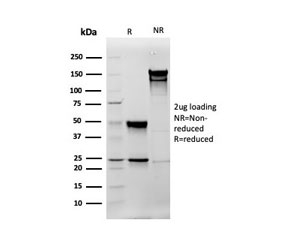 SDS-PAGE analysis of purified, BSA-free Vimentin antibody (clone rVIM/6575) as confirmation of integrity and purity.