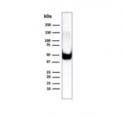 Western blot testing of human U-87 MG cell lysate using Vimentin antibody (clone rVIM/6575). Predicted molecular weight ~53 kDa.