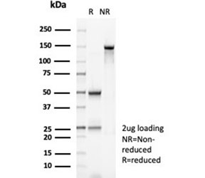 SDS-PAGE analysis of purified, BSA-free MSH2 antibody (clone MSH2/6852) as confirmation of integrity and purity.
