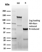 SDS-PAGE analysis of purified, BSA-free recombinant CD7 antibody (clone CD7/6388R) as confirmation of integrity and purity.