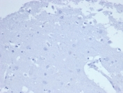 Negative control: IHC staining of FFPE human brain tissue using recombinant CD7 antibody (clone CD7/6388R) at 2ug/ml in PBS for 30min RT. HIER: boil tissue sections in pH 9 10mM Tris with 1mM EDTA for 20 min and allow to cool before testing.