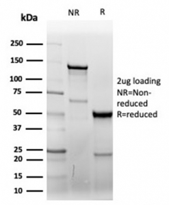 SDS-PAGE analysis of purified, BSA-free recombinant CD7 antibody (clone CD7/6388R) as confirmation of integrity and purity.