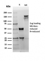 SDS-PAGE analysis of purified, BSA-free CD38 antibody (rCD38/6447) as confirmation of integrity and purity.