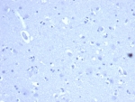 Negative control: IHC staining of FFPE human brain tissue with recombinant CD44 antibody (clone HCAM/6459R) at 2ug/ml in PBS for 30min RT. HIER: boil tissue sections in pH 9 10mM Tris with 1mM EDTA for 20 min and allow to cool before testing.
