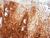 IHC staining of FFPE human esophagus tissue with recombinant CD44 antibody (clone HCAM/6459R). HIER: boil tissue sections in pH 9 10mM Tris with 1mM EDTA for 20 min and allow to cool before testing.