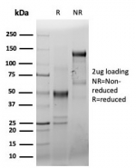 SDS-PAGE analysis of purified, BSA-free recombinant CD44 antibody (clone HCAM/6459R) as confirmation of integrity and purity.