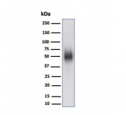 Western blot testing of human Raji cell lysate using CD48 antibody (clone CD48/4784). Expected molecular weight: 28-50 kDa depending on glycosylation level.