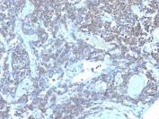 IHC staining of FFPE human lymph node with CD48 antibody (clone CD48/4784). HIER: boil tissue sections in pH 9 10mM Tris with 1mM EDTA for 20 min and allow to cool before testing.