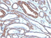 IHC staining of FFPE human kidney tissue with Cadherin 1 antibody (clone CDH1/4585). HIER: boil tissue sections in pH 9 10mM Tris with 1mM EDTA for 20 min and allow to cool before testing.