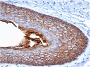 IHC staining of FFPE human skin with Cadherin 1 antibody (clone CDH1/4585). HIER: boil tissue sections in pH 9 10mM Tris with 1mM EDTA for 20 min and allow to cool before testing.