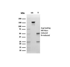 SDS-PAGE analysis of purified, BSA-free Cadherin 1 antibody (clone CDH1/4585) as confirmation of integrity and purity.
