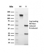 SDS-PAGE analysis of purified, BSA-free recombinant Acidic Cytokeratin antibody (clone rKRTL/6616) as confirmation of integrity and purity.