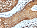 IHC staining of FFPE human skin tissue with recombinant Acidic Cytokeratin antibody (clone rKRTL/6616). HIER: boil tissue sections in pH 9 10mM Tris with 1mM EDTA for 20 min and allow to cool before testing.
