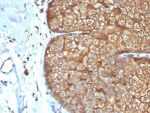 IHC staining of FFPE human sebaceous gland with recombinant Acidic Cytokeratin antibody (clone rKRTL/6616). HIER: boil tissue sections in pH 9 10mM Tris with 1mM EDTA for 20 min and allow to cool before testing.