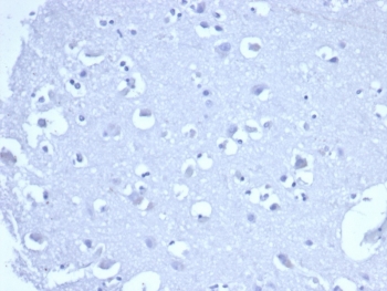Negative control: IHC staining of FFPE human brain tissue with recombinant TROP2 antibody (clone rTACSTD2/6395) at 2ug/ml in PBS for 30min RT. HIER: boil tissue sections in pH 9 10mM Tris with 1mM EDTA for 20 min and allow to cool before testing.