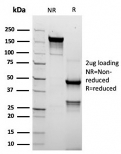 SDS-PAGE analysis of purified, BSA-free recombinant TROP2 antibody (clone rTACSTD2/6395) as confirmation of integrity and purity.