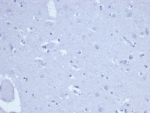 Negative control: IHC staining of FFPE human brain tissue with recombinant TOP2A antibody (clone rTOP2A/6569) at 2ug/ml in PBS for 30min RT. HIER: boil tissue sections in pH 9 10mM Tris with 1mM EDTA for 20 min and allow to cool before testing.