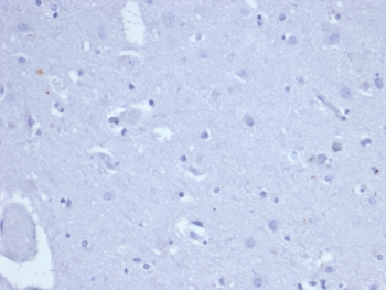 Negative control: IHC staining of FFPE human brain tissue with recombinant TOP2A antibody (clone rTOP2A/6569) at 2ug/ml in PBS for 30min RT. HIER: boil tissue sections in pH 9 10mM Tris with 1mM EDTA for 20 min and allow to cool before testing.