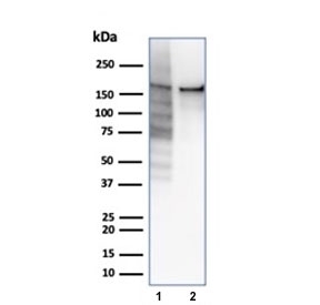 Western blot testing of human 1) HeLa and 2) Jurkat cell lysate using recombinant TOP2A antibody (clone rTOP2A/6569). Predicted molecular weight ~174 kDa.