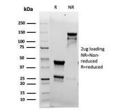 SDS-PAGE analysis of purified, BSA-free recombinant TOP2A antibody (clone rTOP2A/6569) as confirmation of integrity and purity.