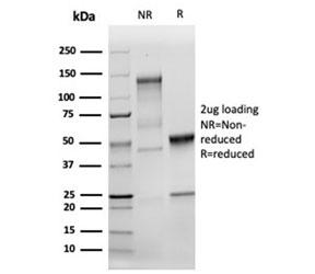 SDS-PAGE analysis of purified, BSA-free MSH2 antibody (clone MSH2/6549R) as confirmation of integrity and purity.