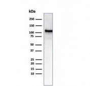 Western blot testing of human HCT-116 cell lysate using MSH2 antibody (clone MSH2/6549R). Expected molecular weight ~105 kDa.