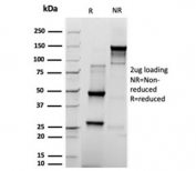 SDS-PAGE analysis of purified, BSA-free recombinant PRL antibody (rPRL/4909) as confirmation of integrity and purity.