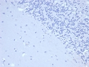 Negative control: IHC staining of FFPE human brain tissue using recombinant PRL antibody (clone rPRL/4909) at 2ug/ml in PBS for 30min RT. HIER: boil tissue sections in pH 9 10mM Tris with 1mM EDTA for 20 min and allow to cool before testing.