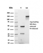 SDS-PAGE analysis of purified, BSA-free recombinant Basic Cytokeratin antibody (clone rKRTH/6617) as confirmation of integrity and purity.