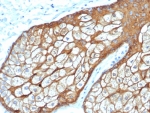 IHC staining of FFPE human sebaceous gland tissue with recombinant Basic Cytokeratin antibody (clone rKRTH/6617). HIER: boil tissue sections in pH 9 10mM Tris with 1mM EDTA for 20 min and allow to cool before testing.