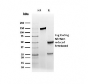 SDS-PAGE analysis of purified, BSA-free recombinant AMACR antibody (clone rAMACR/6369) as confirmation of integrity and purity.