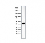 Western blot testing of human kidney lysate using recombinant AMACR antibody (clone rAMACR/6369). Predicted molecular weight ~43 kDa.