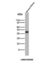 Recombinant AMACR / p504S Antibody Human Kidney WB. Western blot analysis of human kidney tissue lysate using recombinant AMACR / p504S Antibody clone rAMACR/6369 demonstrates a distinct band at approximately 40-42 kDa, consistent with the predicted molecular weight of Alpha-methylacyl-CoA racemase / AMACR. The observed signal supports expression of this peroxisomal and mitochondrial metabolic enzyme involved in branched-chain fatty acid and bile acid metabolism within renal tissue.