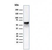 Western blot testing of human Hep-2 cell lysate using recombinant HSP60 antibody (clone rHSPD1/6497). Predicted molecular weight: ~60 kDa.