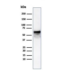 Western blot testing of human Hep-2 cell lysate using recombinant HSP60 antibody (clone rHSPD1/6497). Predicted molecular weight: ~60 kDa.
