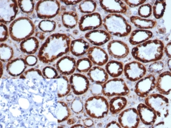 IHC staining of FFPE human kidney tissue with recombinant HSP60 antibody (clone rHSPD1/6497). Negative control inset: PBS instead of primary antibody to control for secondary binding. HIER: boil tissue sections in pH 9 10mM Tris with 1mM EDTA for 20 min and allow to cool before testing.