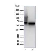 Western blot testing of human 1) Hep-2 and 2) HeLa cell lysate using recombinant HSP60 antibody (clone rHSPD1/6497). Predicted molecular weight: ~60 kDa.