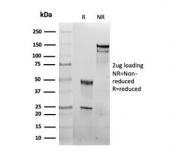 SDS-PAGE analysis of purified, BSA-free recombinant HSP60 antibody (clone rHSPD1/6497) as confirmation of integrity and purity.