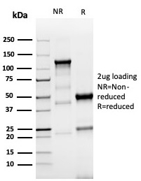 SDS-PAGE analysis of purified, BSA-free recombinant TROP2 antibody (clone TACSTD2/6396R) as confirmation of integrity and purity.