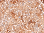 IHC staining of FFPE human adrenal gland tissue with Clusterin antibody (clone CLU/4730). HIER: boil tissue sections in pH 9 10mM Tris with 1mM EDTA for 20 min and allow to cool before testing.