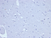 Negative control: IHC staining of FFPE human brain tissue using recombinant Topoisomerase II alpha antibody (clone TOP2A/6570R) at 2ug/ml in PBS for 30min RT. HIER: boil tissue sections in pH 9 10mM Tris with 1mM EDTA for 20 min and allow to cool before testing.