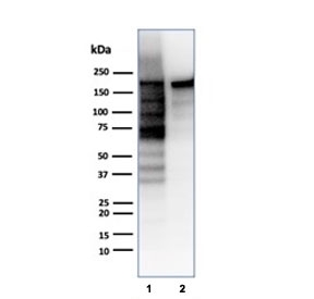 Western blot testing of human HeLa and Jurkat cell lysates using recombinant Topoisomerase II alpha antibody (clone TOP2A/6570R). Predicted molecular weight ~174 kDa.