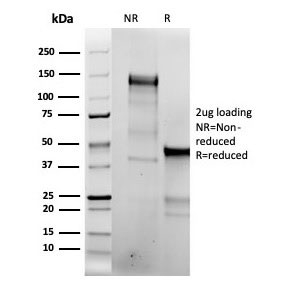 SDS-PAGE analysis of purified, BSA-free recombinant Topoisomerase II alpha antibody (clone TOP2A/6570R) as confirmation of integrity and purity.