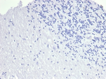 Negative control: IHC staining of FFPE human brain tissue with TACSTD2 antibody (clone TACSTD2/6394R) at 2ug/ml in PBS for 30min RT. HIER: boil tissue sections in pH 9 10mM Tris with 1mM EDTA for 20 min and allow to cool before testing.
