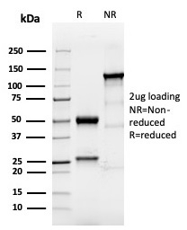 SDS-PAGE analysis of purified, BSA-free TACSTD2 antibody (clone TACSTD2/6394R) as confirmation of integrity and purity.