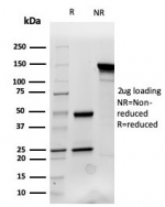 SDS-PAGE analysis of purified, BSA-free Cytokeratin 14 antibody (clone KRT14/4132) as confirmation of integrity and purity.