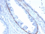 IHC staining of FFPE human prostate tissue with Cytokeratin 14 antibody (clone KRT14/4132). HIER: boil tissue sections in pH 9 10mM Tris with 1mM EDTA for 20 min and allow to cool before testing.