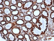 IHC staining of FFPE human liver tissue with HSP60/GROEL antibody (clone HSPD1/6498R). HIER: boil tissue sections in pH 9 10mM Tris with 1mM EDTA for 20 min and allow to cool before testing.